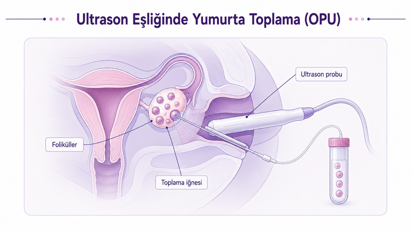 Yumurta toplama işlemi (OPU)