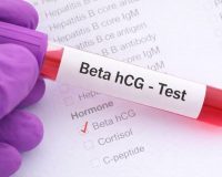 Tüp Bebek Sonrası Beta HCG Değeri Kaç Olmalı? Sonuç Nasıl Yorumlanır?